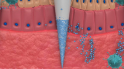Microneedle in action from 3D animation